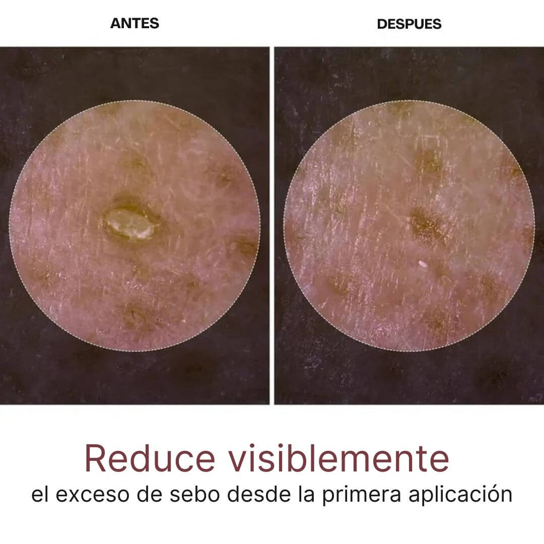 DR MELAXIN | Dúo serum de arroz Peel Shot Glow: para iluminar, exfoliar e hidratar tu piel✨